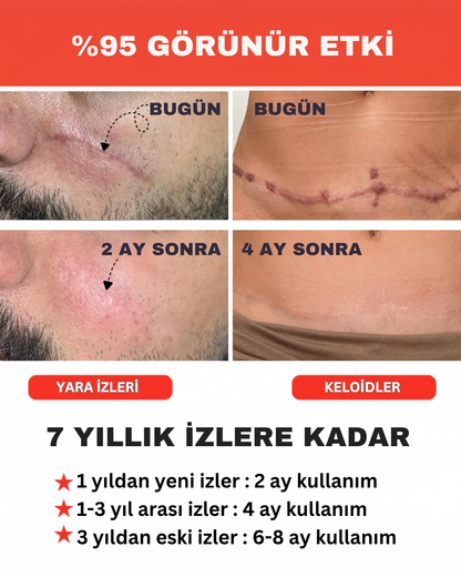 ScarTape - İz Giderici Bant