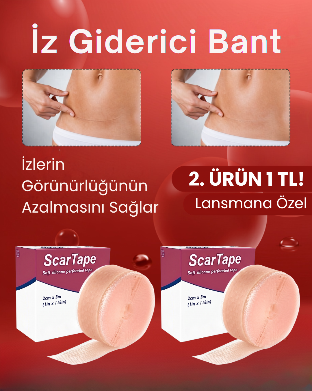 ScarTape - İz Giderici Bant