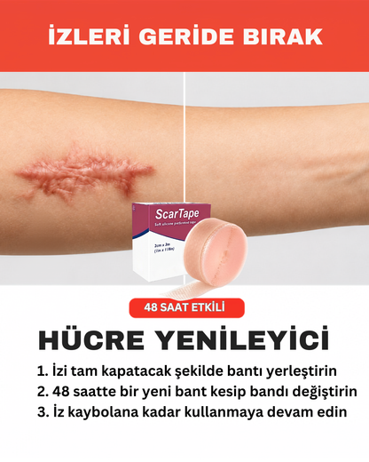 ScarTape - İz Giderici Bant